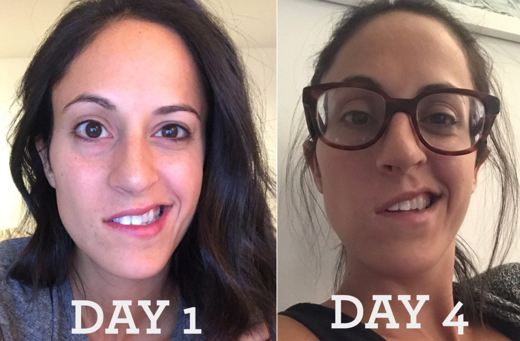 Bell's Palsy - How I Healed Naturally and What I Learned From It